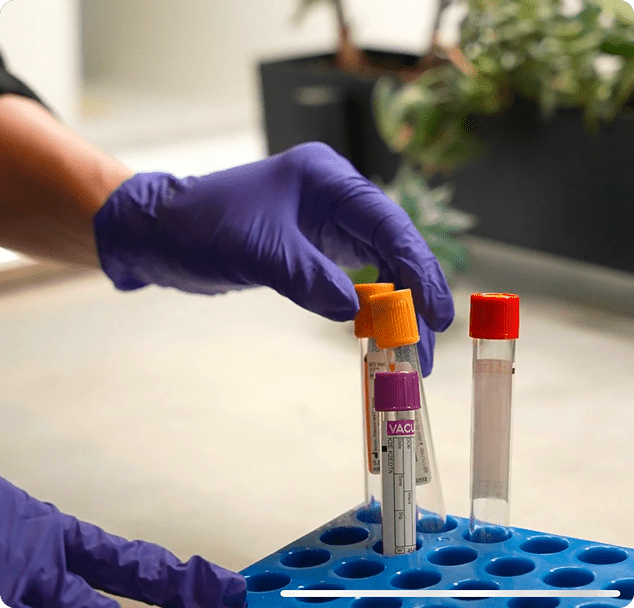 Medical professional handling blood sample collection tubes during laboratory testing at a medical clinic in Edina, Minnesota.